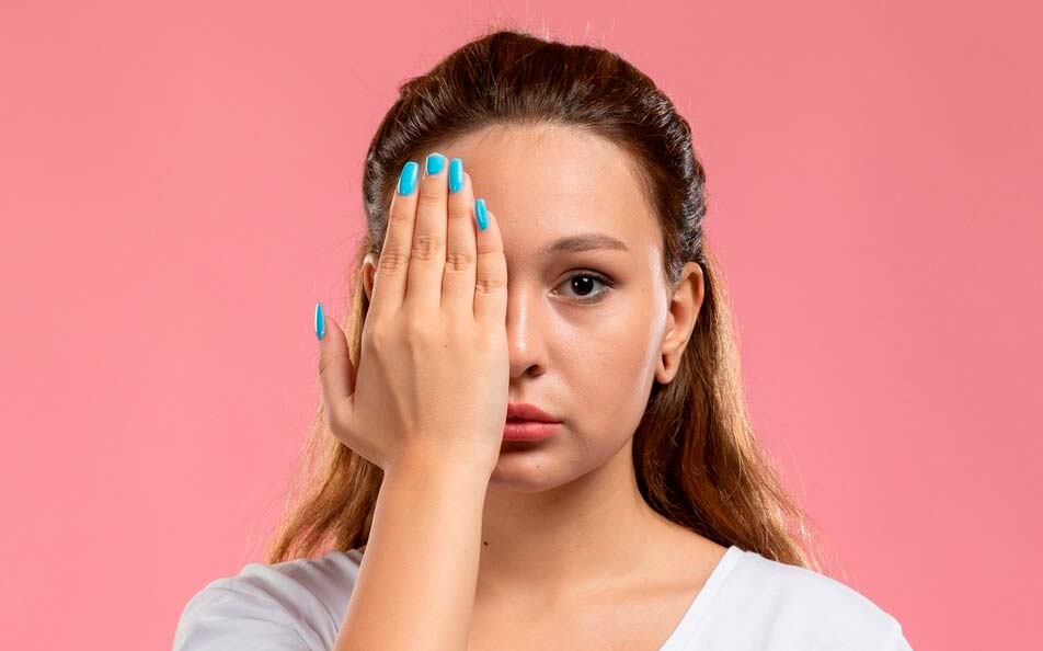 Moça com síndrome do olho seco Síndrome do Olho Seco